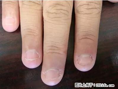 剪指甲、挖耳屎，这些日常小动作竟隐藏大危害！ - 合肥生活资讯 - 合肥28生活网 hf.28life.net